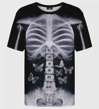 X-ray t-shirt